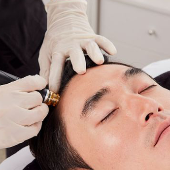 scalp exfoliation